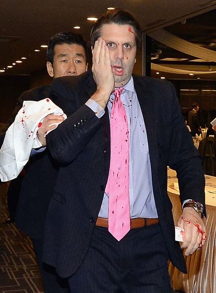 , El embajador estadounidense en Corea del Sur de Mark Lippert se observa después de sufrir un ataque el 5 de marzo, 2015, en Seúl, Corea del Sur.