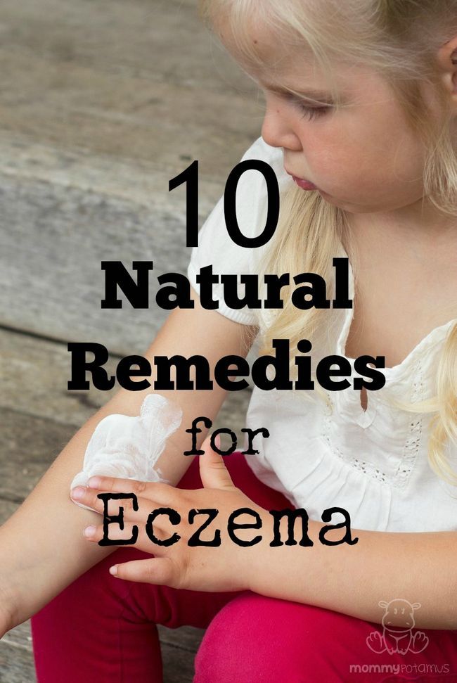 -remedios naturales eczema