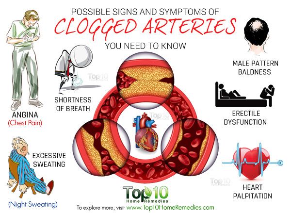 posibles signos y síntomas de la obstrucción de las arterias