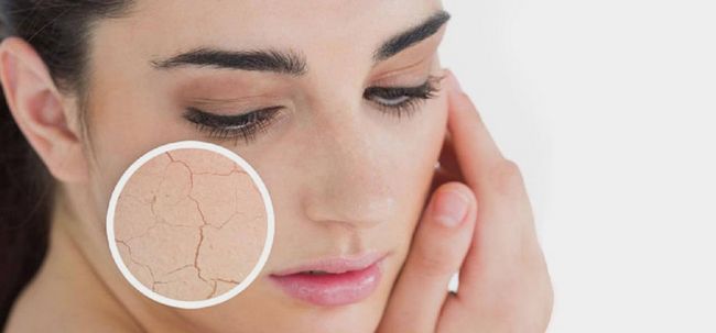 10 mejores consejos para la piel seca