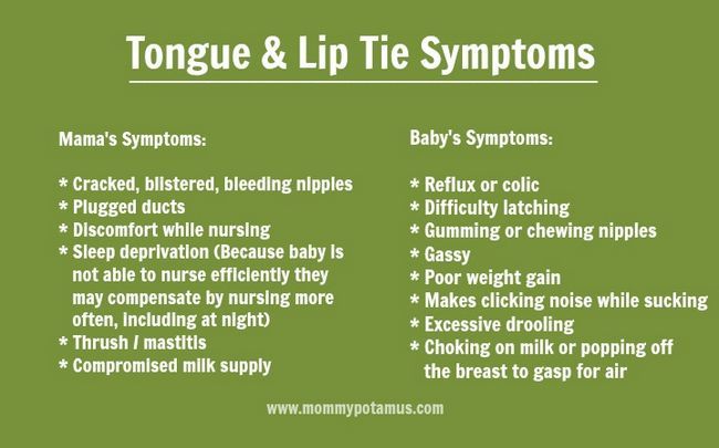 tongue-tie-síntomas-5