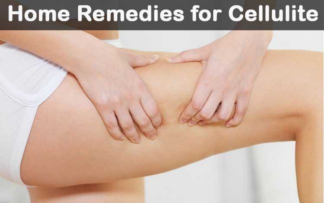 13 remedios caseros para la celulitis