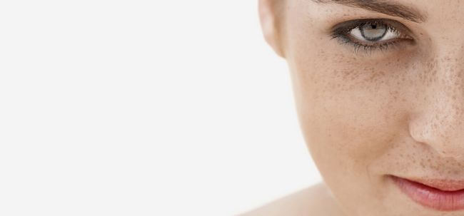 14 maneras simples para deshacerse de las pecas