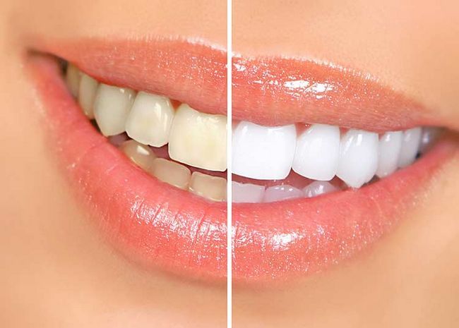 16 maneras naturales de bricolaje para blanquear los dientes