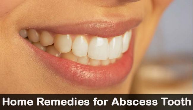 19 remedios caseros de bricolaje para diente absceso