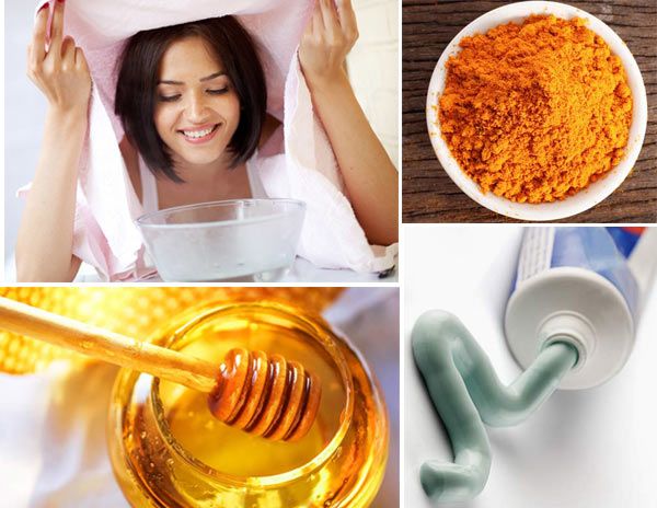 Remedios caseros para las espinillas