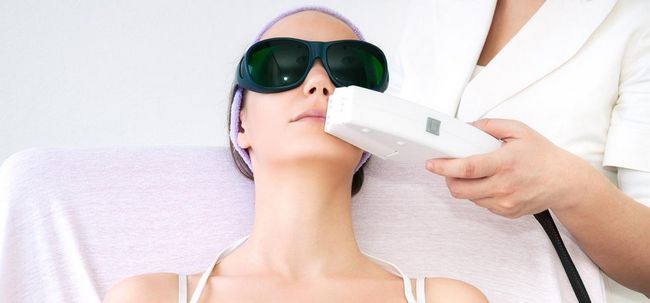 5 tipos de tratamientos láser para la piel y sus ventajas