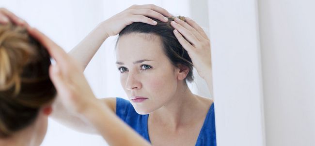 7 maneras eficaces para tratar la pérdida de cabello debido a un desequilibrio hormonal