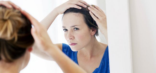 8 diferentes métodos para revertir la pérdida de cabello