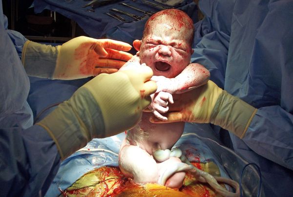 ¿Existen procedimientos de nacimiento del hospital peligroso?