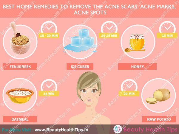 Los mejores remedios caseros para eliminar las cicatrices del acné, marcas de acné, manchas de acné