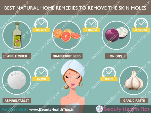 Best-naturales-hogar-remedios-para-eliminar-las-piel-topos