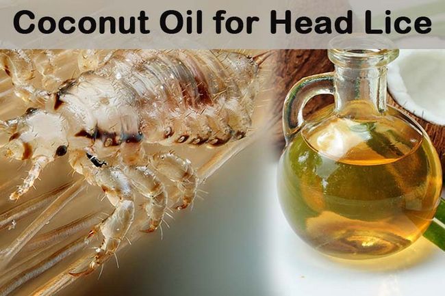 El aceite de coco para los piojos de la cabeza