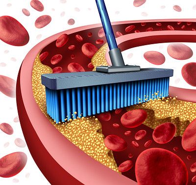 Limpieza arterias colesterol-opt