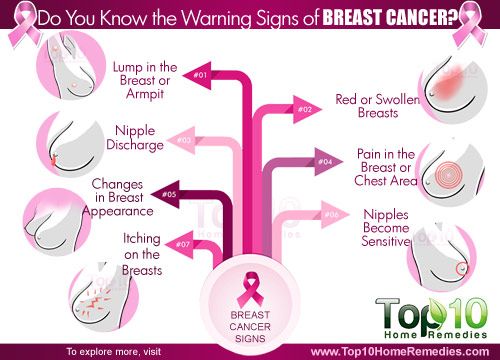 señales de advertencia de cáncer de mama