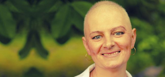 Conduce quimioterapia para la pérdida del cabello?