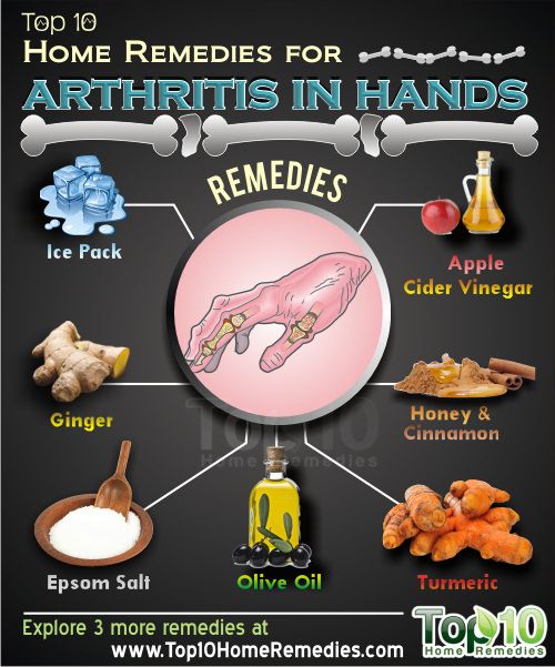 la artritis en los remedios manos