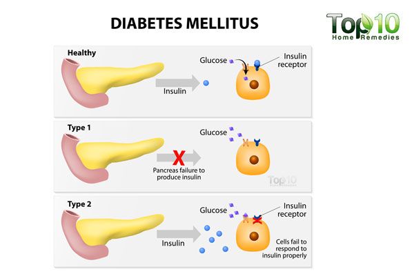 diagrama de la diabetes