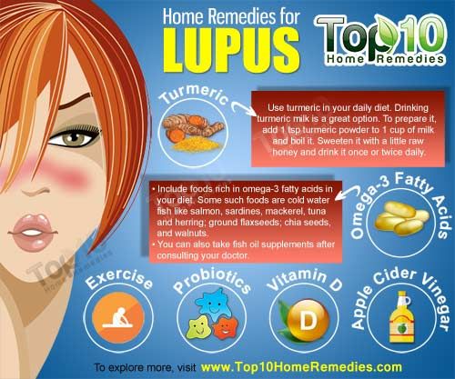 remedios caseros para el lupus