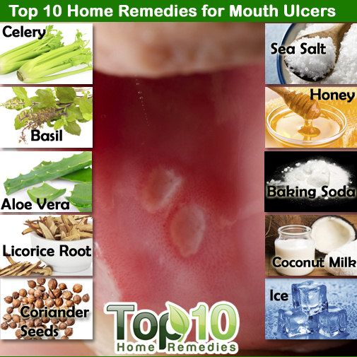 cura de úlceras en la boca