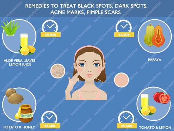 -Home-remedios-to black-manchas-treat, -dark-spots, -acne marcas, -Pimple-cicatrices-en-la-cara