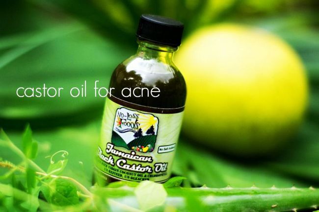 ¿Cómo se utiliza el aceite de ricino para el acné?