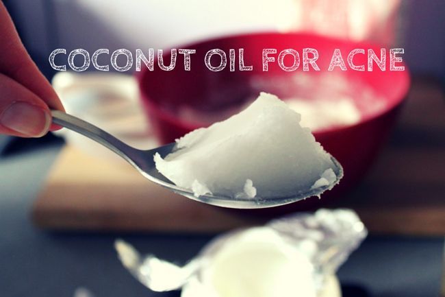 el aceite de coco para el acné
