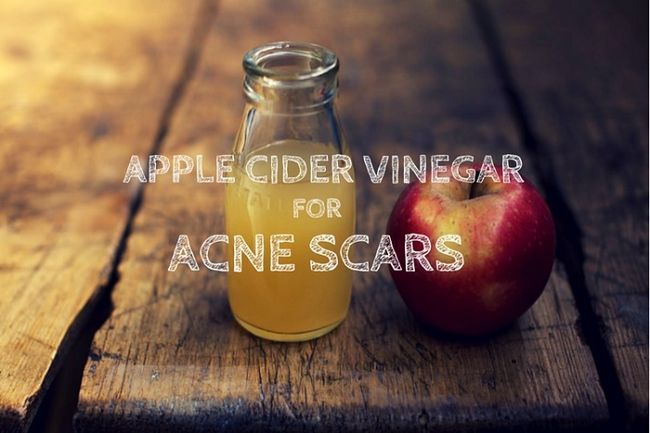 ¿Cómo curar las cicatrices del acné rápidamente con vinagre de manzana