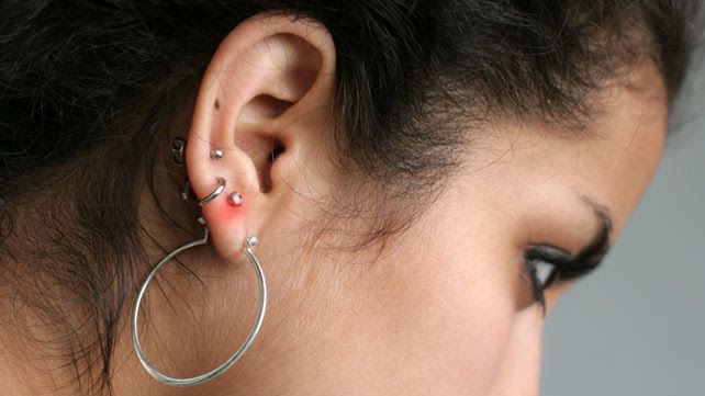Cómo curar la infección de la perforación del oído