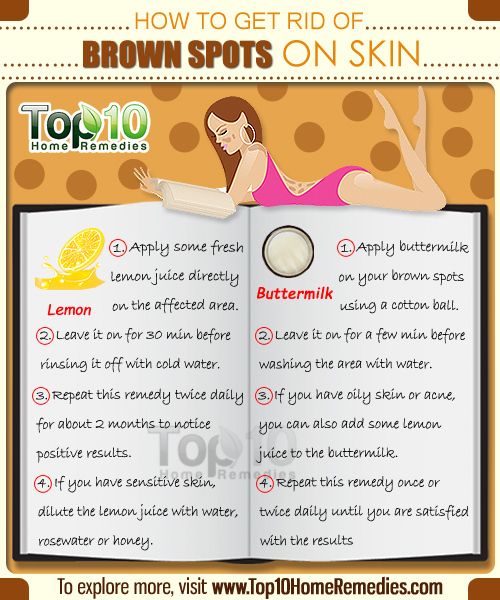 cómo deshacerse de manchas marrones en la piel