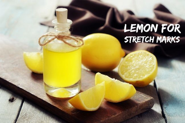 ¿Cómo deshacerse de las estrías con limón
