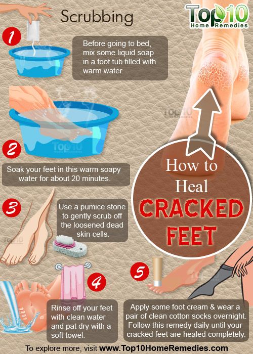 cómo curar pies de crack