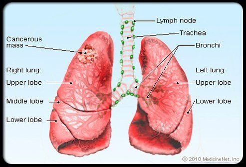 pulmones