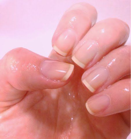 Cómo quitar las manchas de las uñas y la piel alrededor sin usar peróxido