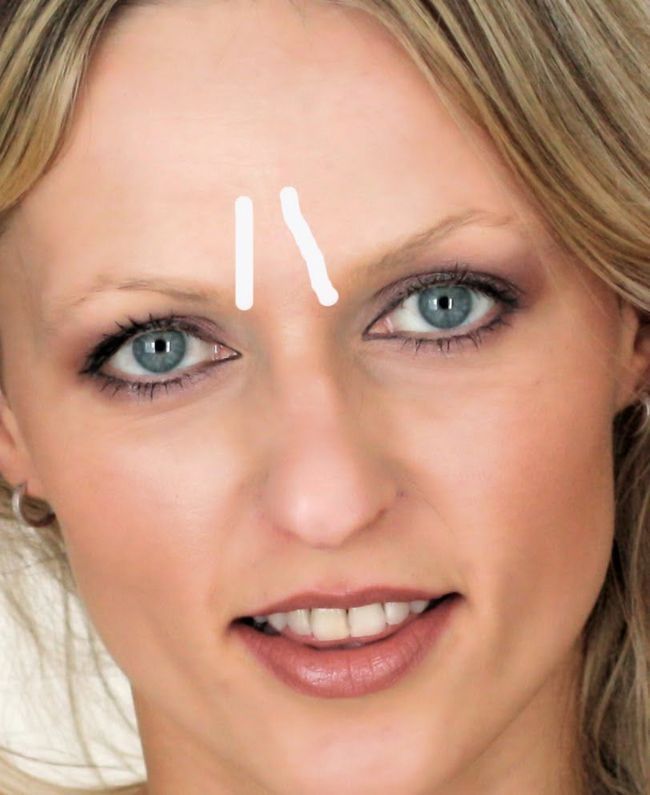 Cómo eliminar las arrugas entre las cejas
