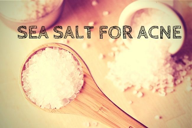 Cómo tratar el acné rápidamente con la sal del mar (no. 1 y 3 es el mejor)