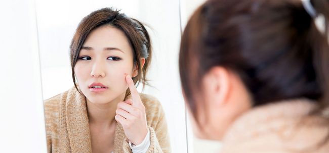 Es el Aceite de Orégano una cura efectiva para el acné?