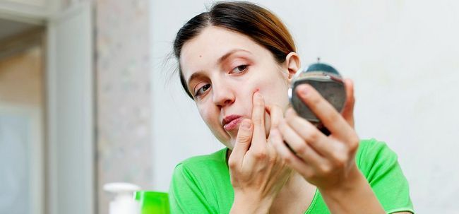 Es la vitamina E del aceite eficaz para el acné y las espinillas?