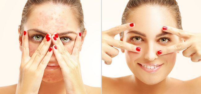 Cosas maquillaje Allergy- Usted debe ser consciente de