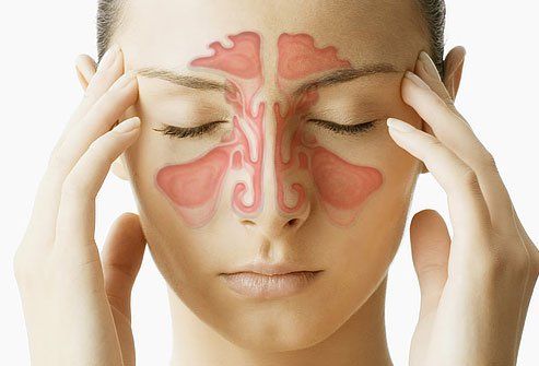 Remedios caseros sinusitis, consejos y tratamiento