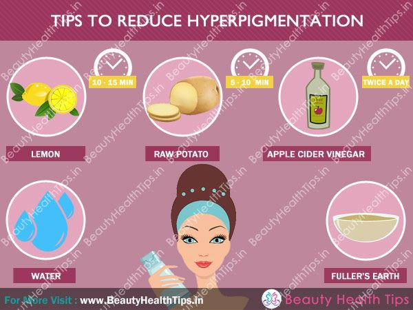 Consejos para reducir la hiperpigmentación