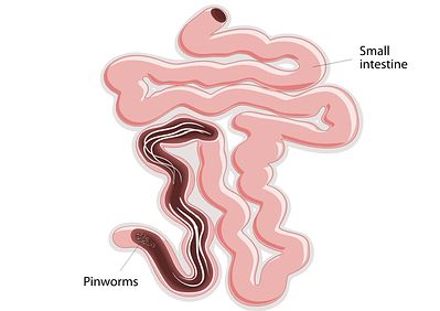 combate los parásitos intestinales