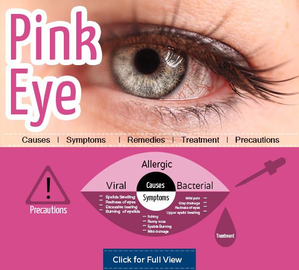 Obtener alivio de Pink Eye