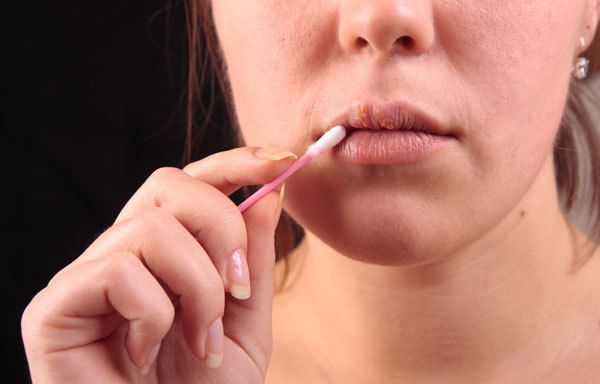 labios secos