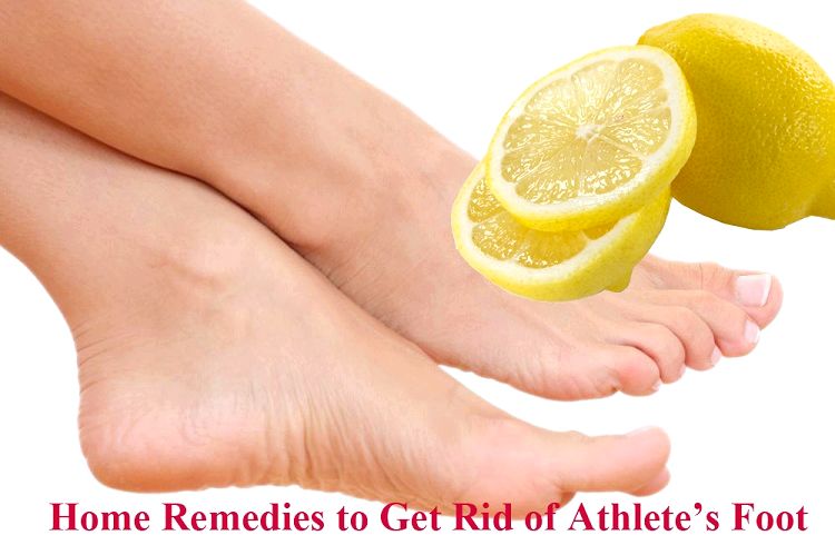 15 Remedios caseros para deshacerse de pie de atleta