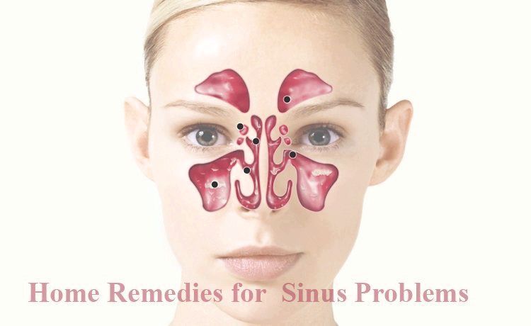 20 simples remedios caseros para la Reducción de sinusitis