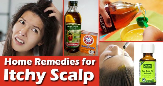 14 Fast Remedios caseros para el cuero cabelludo que pica
