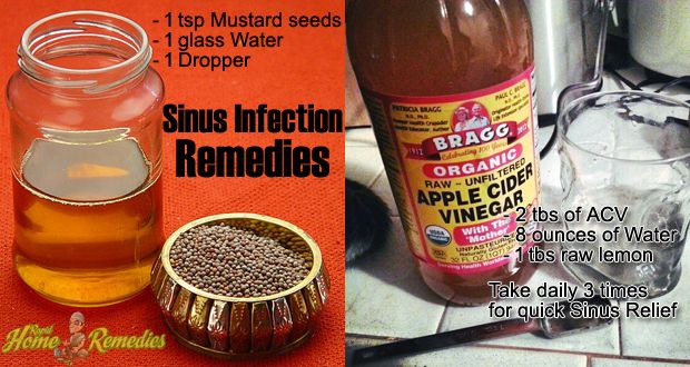 14 remedios caseros simples para infección sinusal