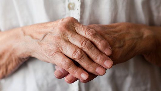 Remedios alivio natural del dolor para la artritis en las manos